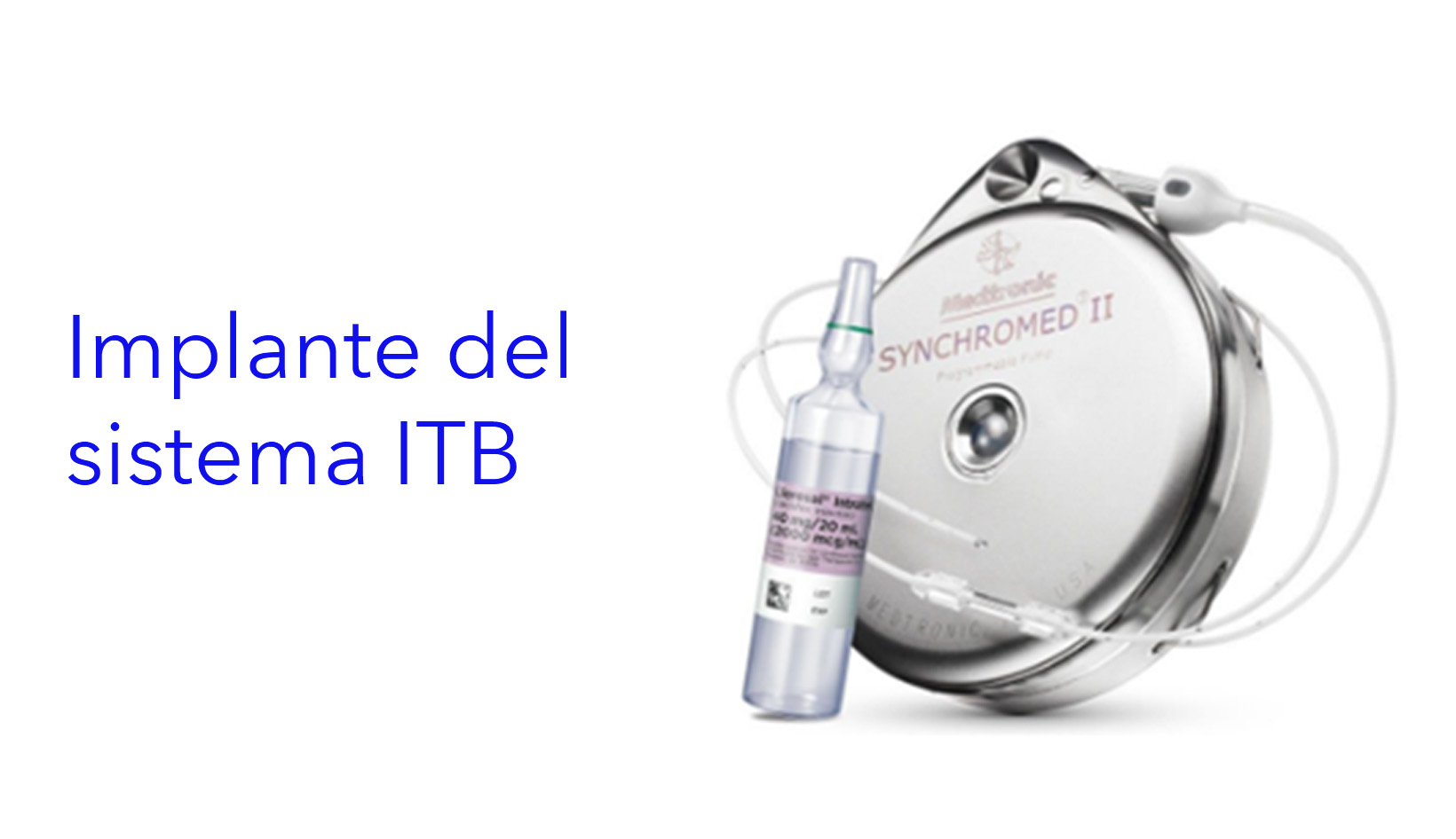 Implante del sistema ITB.