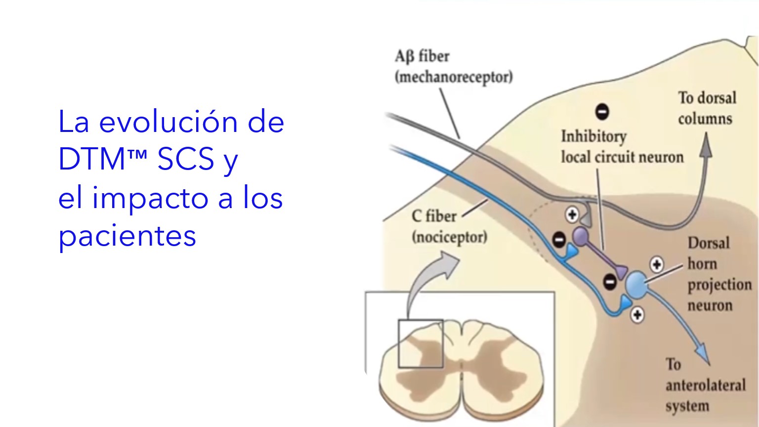 Lección Programador del Paciente Intellis.