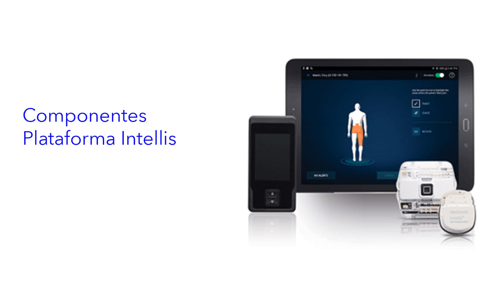 Revisión Clínica y entrenamiento virtual del sistema de Ablación por RF OsteoCool™ 