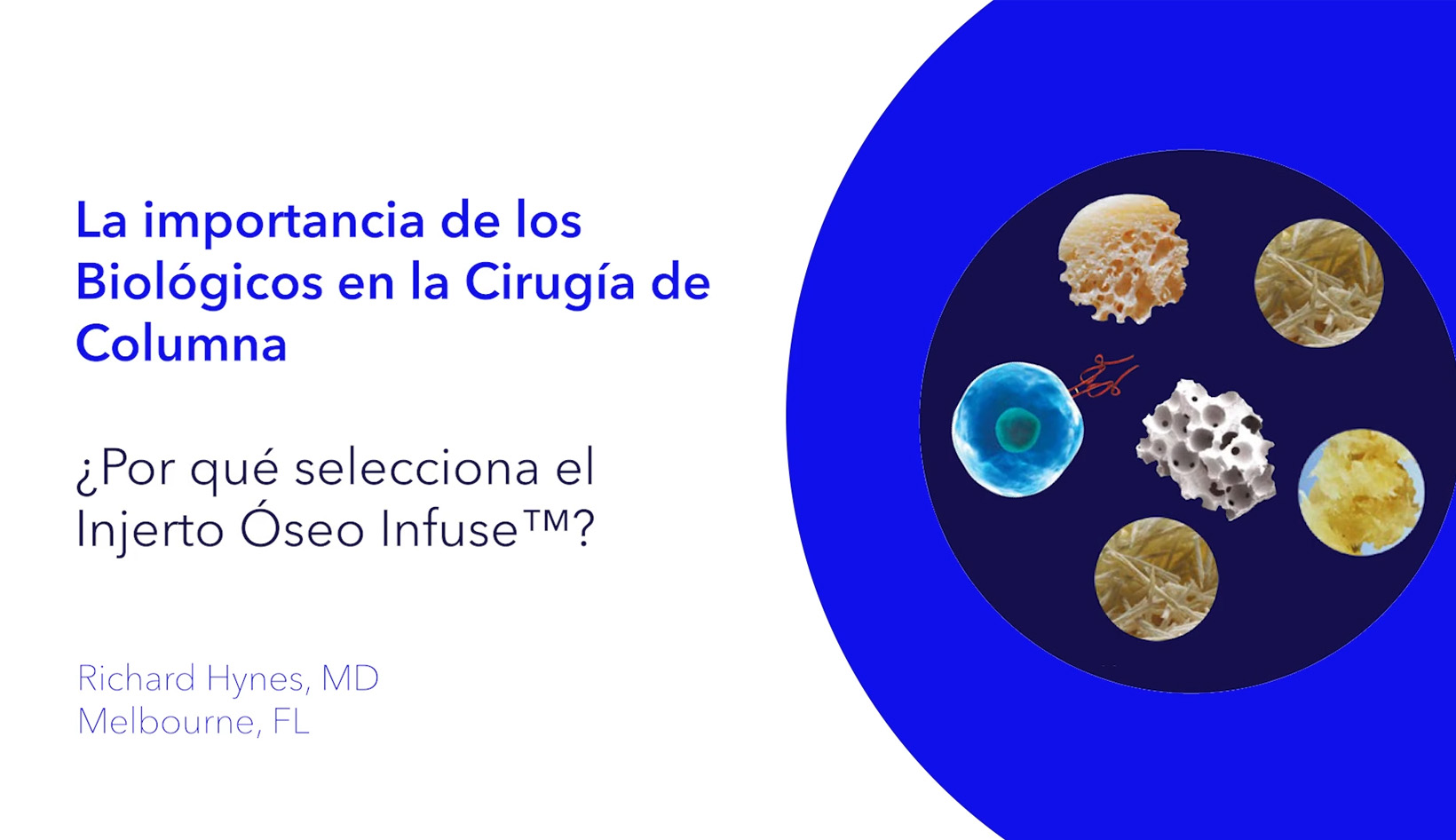 La importancia de los biológicos en la cirugía de columna. ¿Por qué selecciona el injerto óseo Infuse?