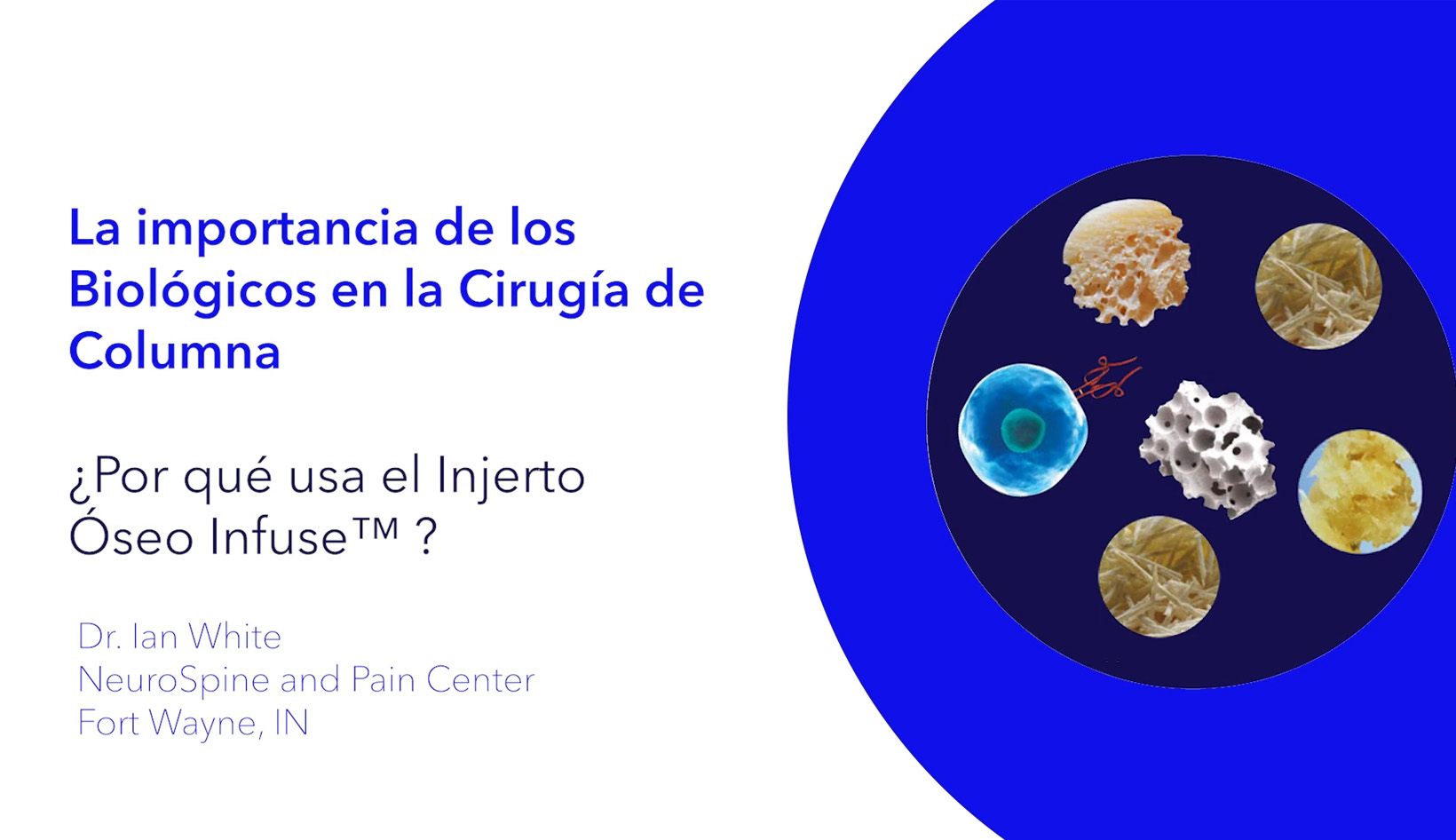 La importancia de los biológicos en la cirugía de columna. Los beneficios de Infuse Bone Graft.