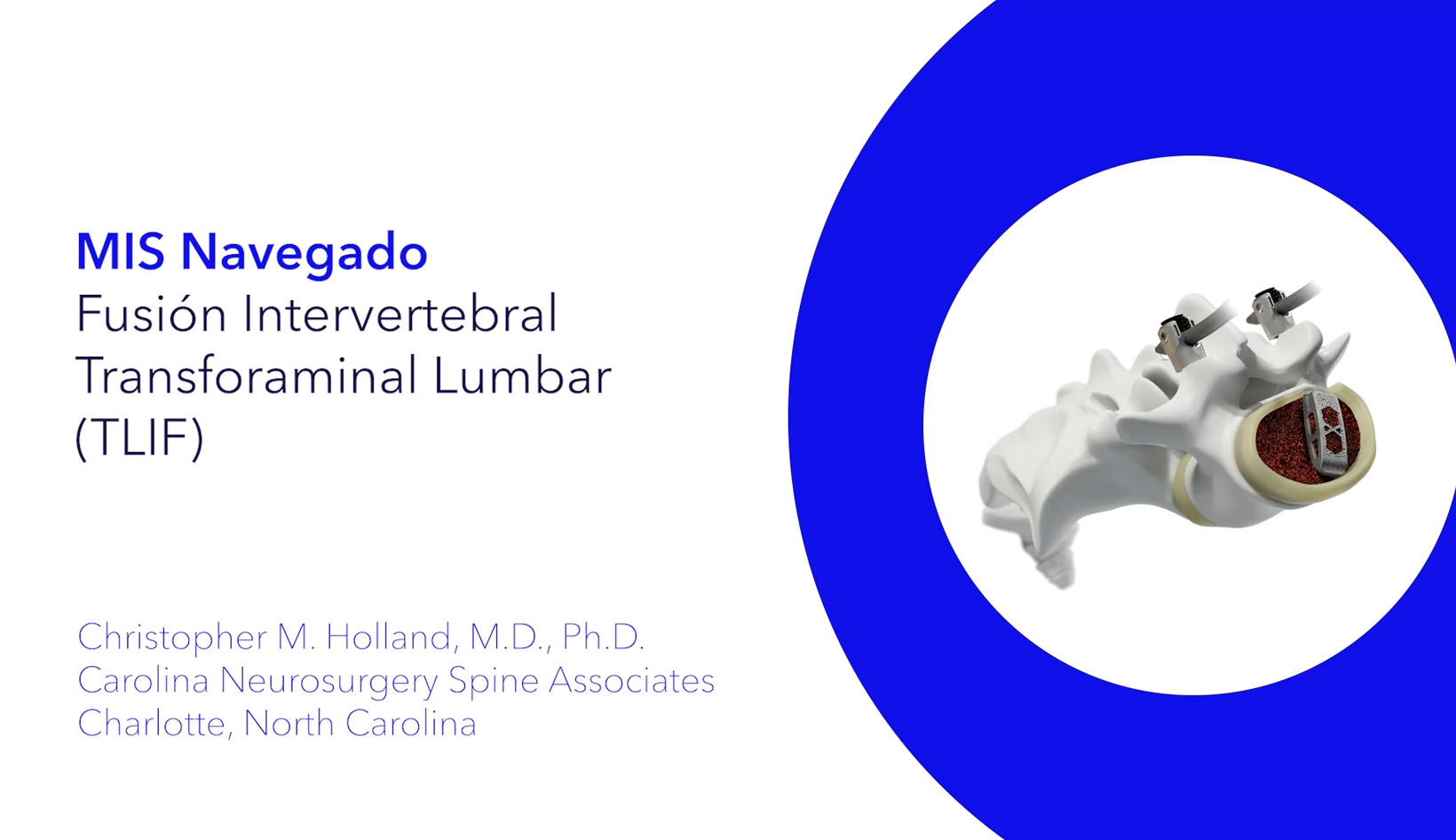 Perpectiva del Faculty: Distractor, compresor y retractor Space D