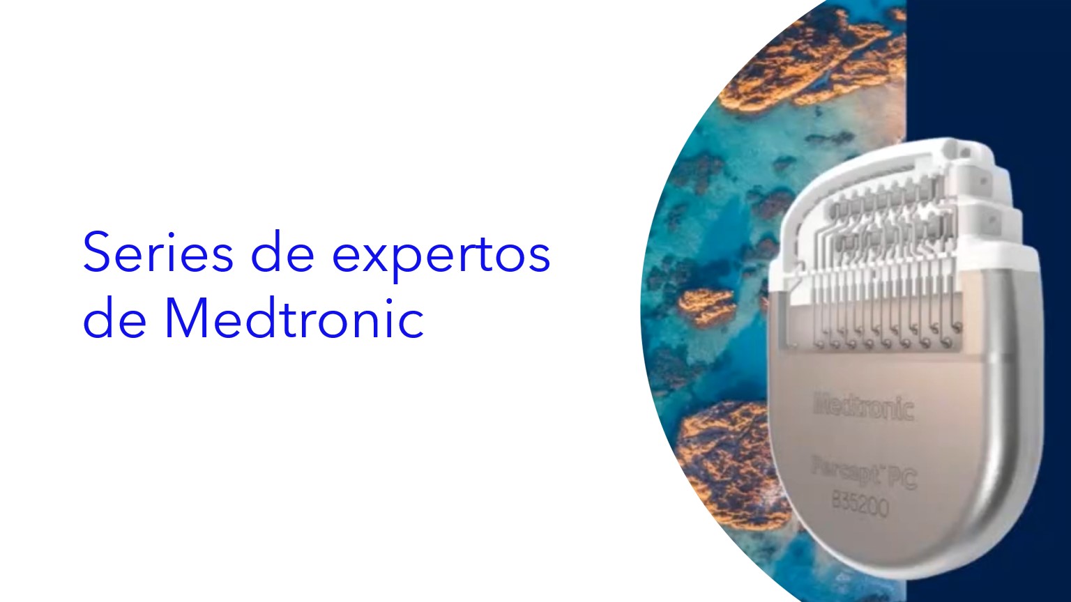 Serie de expertos de Medtronic