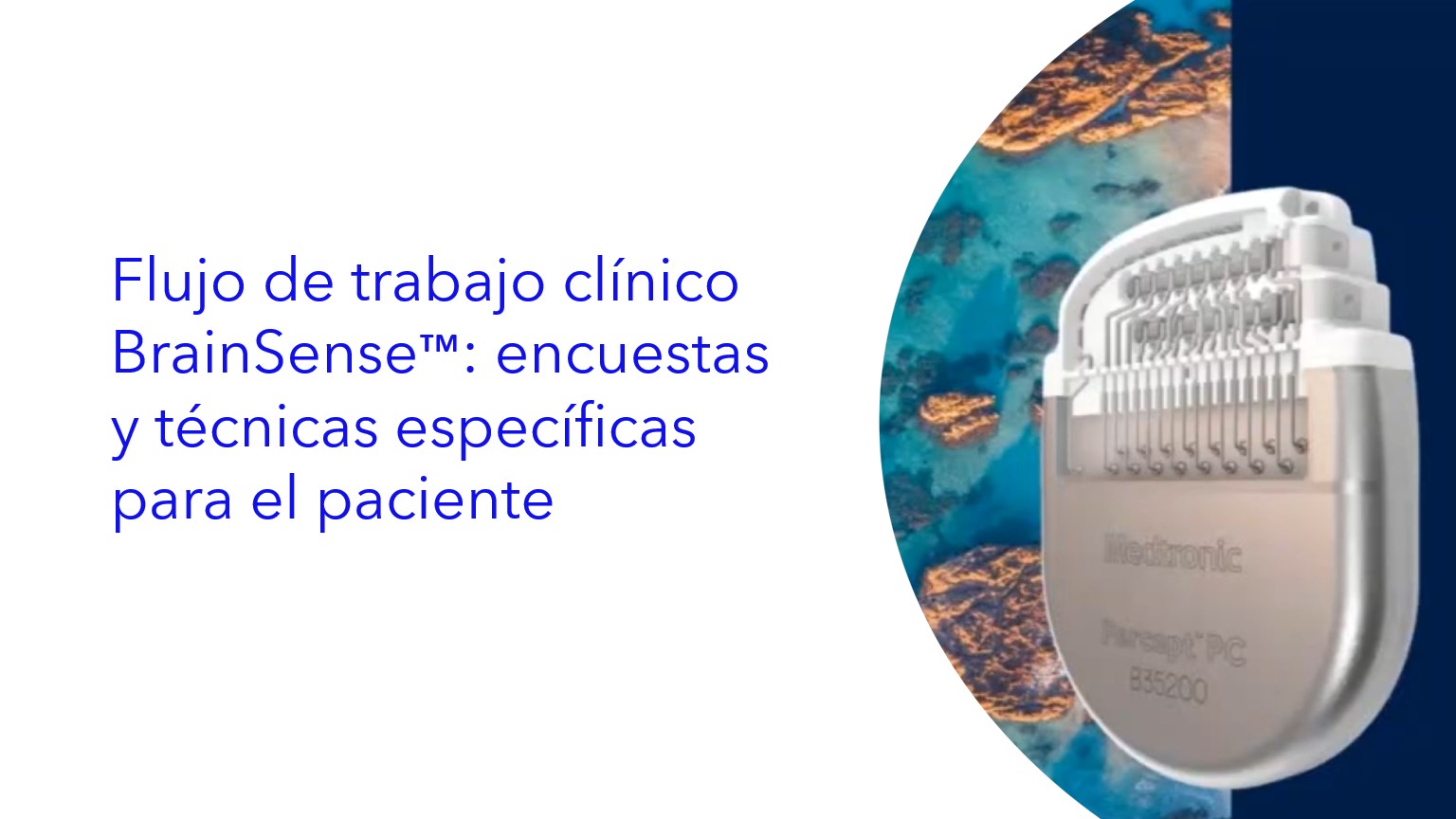 Flujo de trabajo clínico BrainSense™: encuestas y técnicas específicas para el paciente . | Fluxo de trabalho clínico BrainSense™: pesquisa e técnicas específicas do paciente . | BrainSense™ Clinical Workflow: Survey and Patient Specific Techniques .