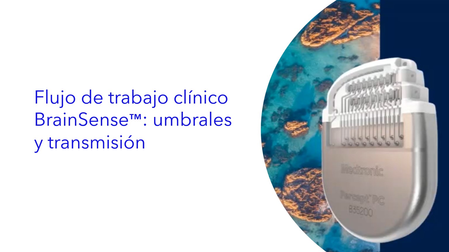 Flujo de trabajo clínico BrainSense™: umbrales y transmisión . |  Fluxo de trabalho clínico BrainSense™: limites e streaming . | BrainSense™ Clinical Workflow: Thresholds and Streaming .