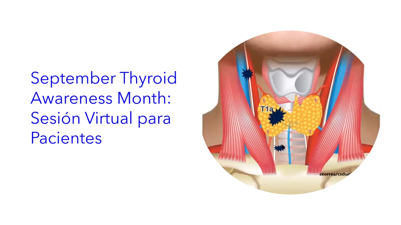 September Thyroid Awareness Month: Sesión Virtual para Pacientes . | Mês de Conscientização da Tireóide em Setembro: Sessão Virtual com Pacientes . | September Thyroid Awareness Month: Virtual Patient Session .