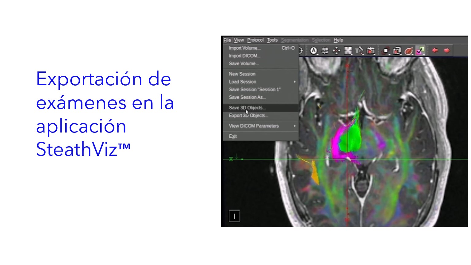 Exportación de exámenes en la aplicación SteathViz™