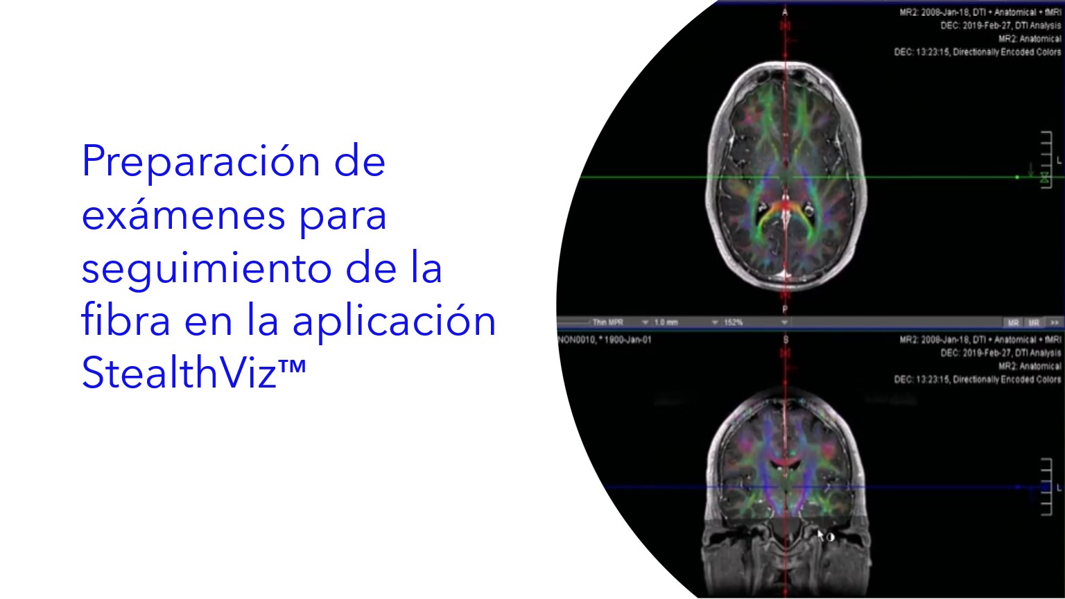 Preparación de exámenes para seguimiento de la fibra en la Aplicación StealthViz™