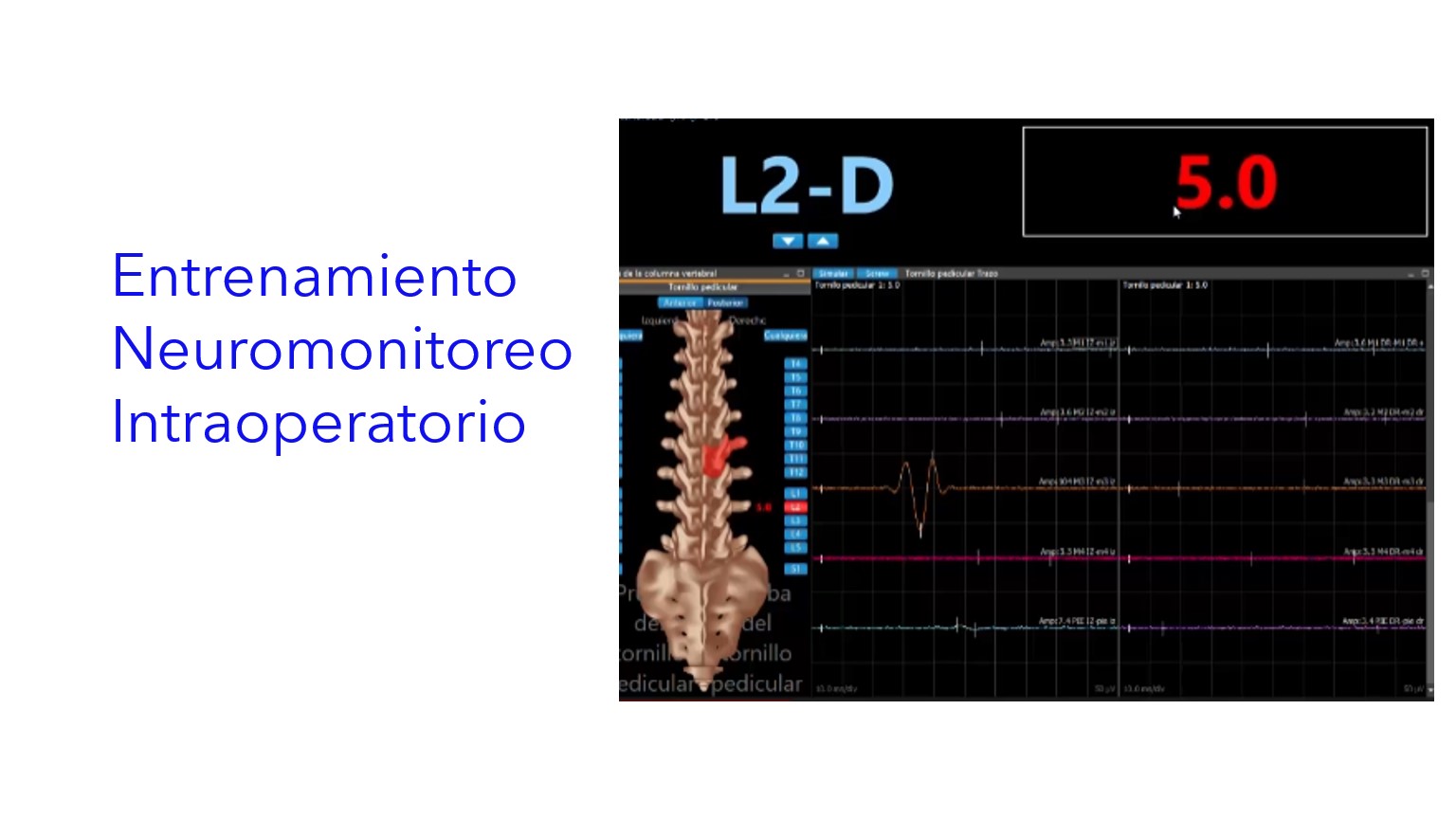 Entrenamiento Neuromonitoreo Intraoperatorio