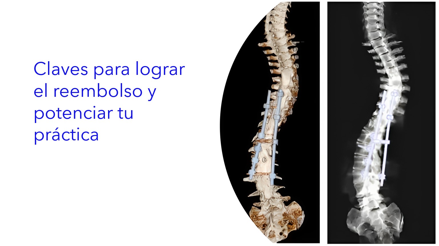 Claves para lograr el reembolso y potenciar tu práctica