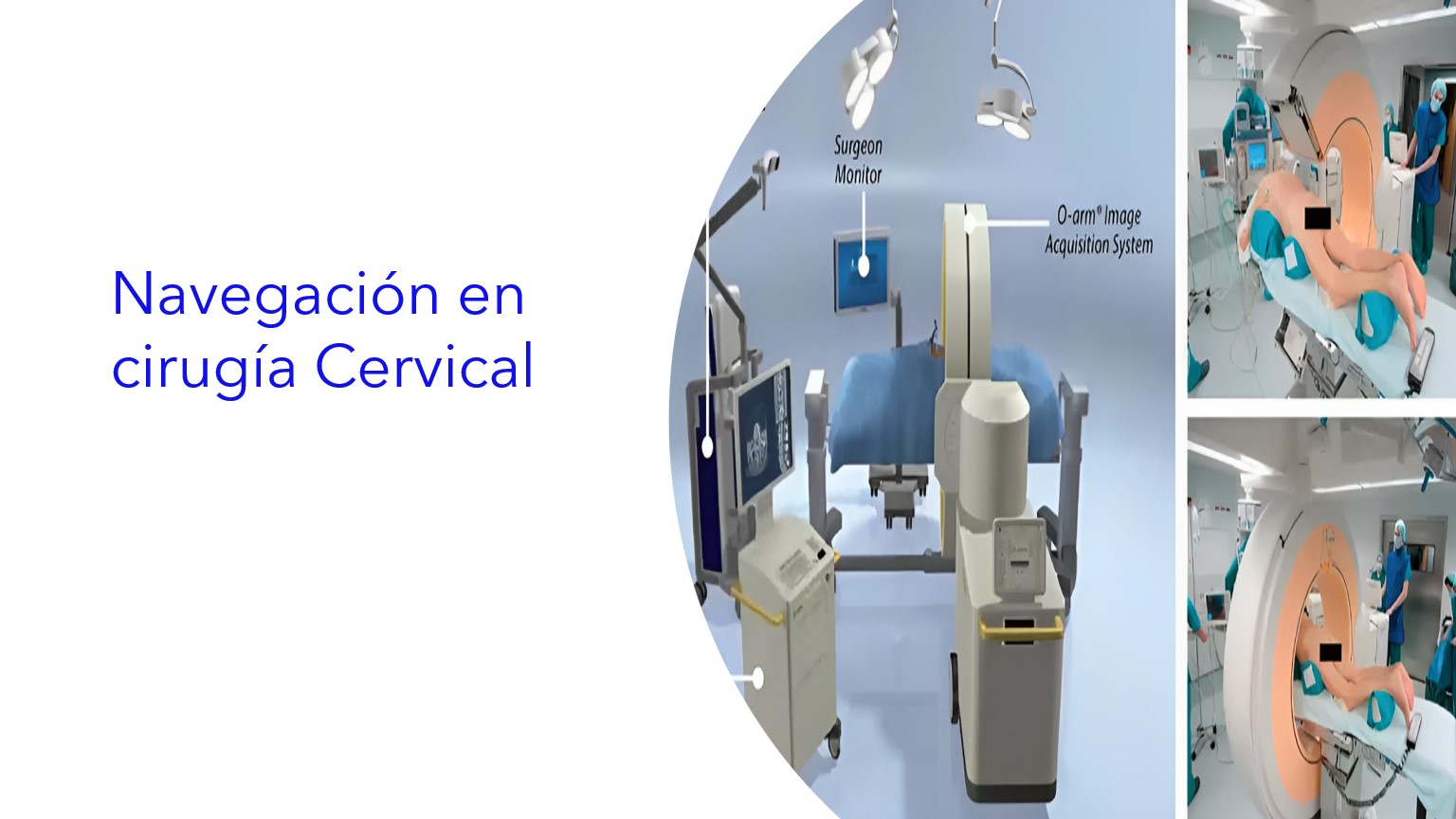 Navegación en cirugía Cervical