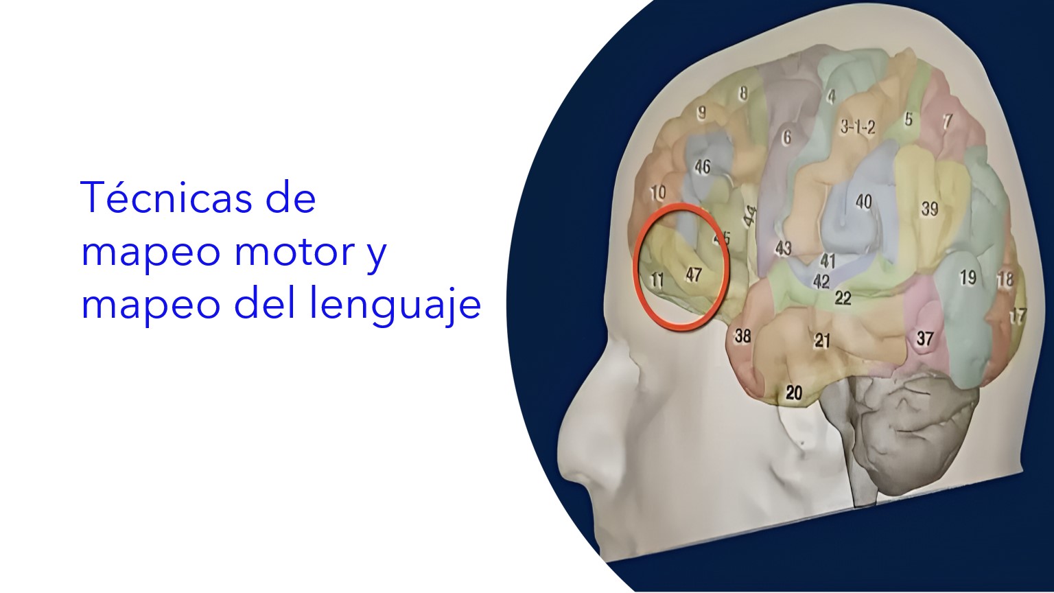 Técnicas de Mapeo Motor y Mapeo del Lenguaje . | Técnicas de mapeamento motor e mapeamento de linguagem . | Motor Mapping and Language Mapping Techniques .