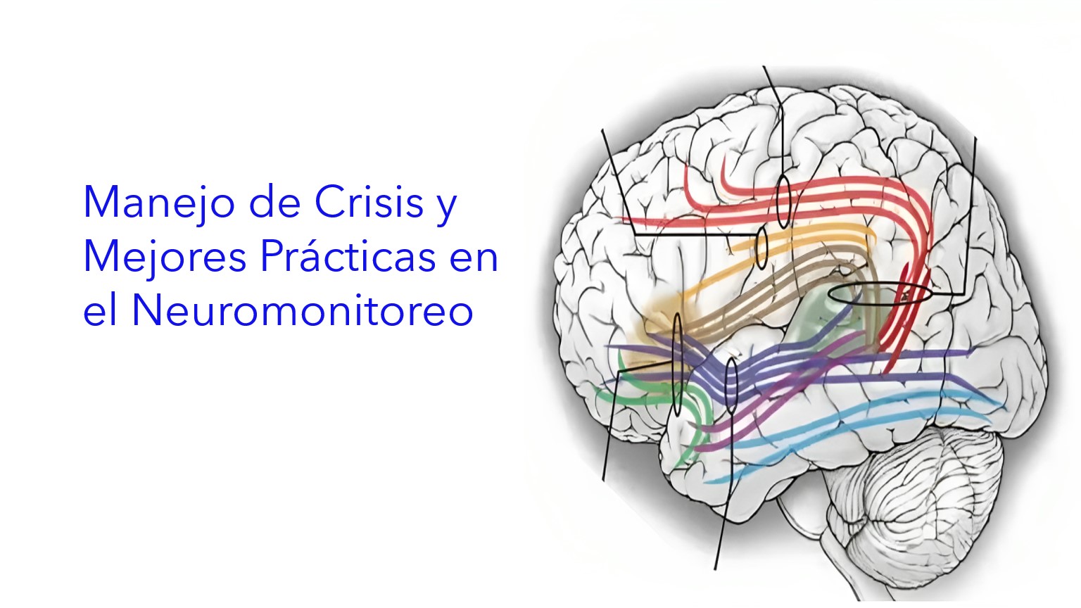 Manejo de Crisis y Mejores Prácticas en el Neuromonitoreo