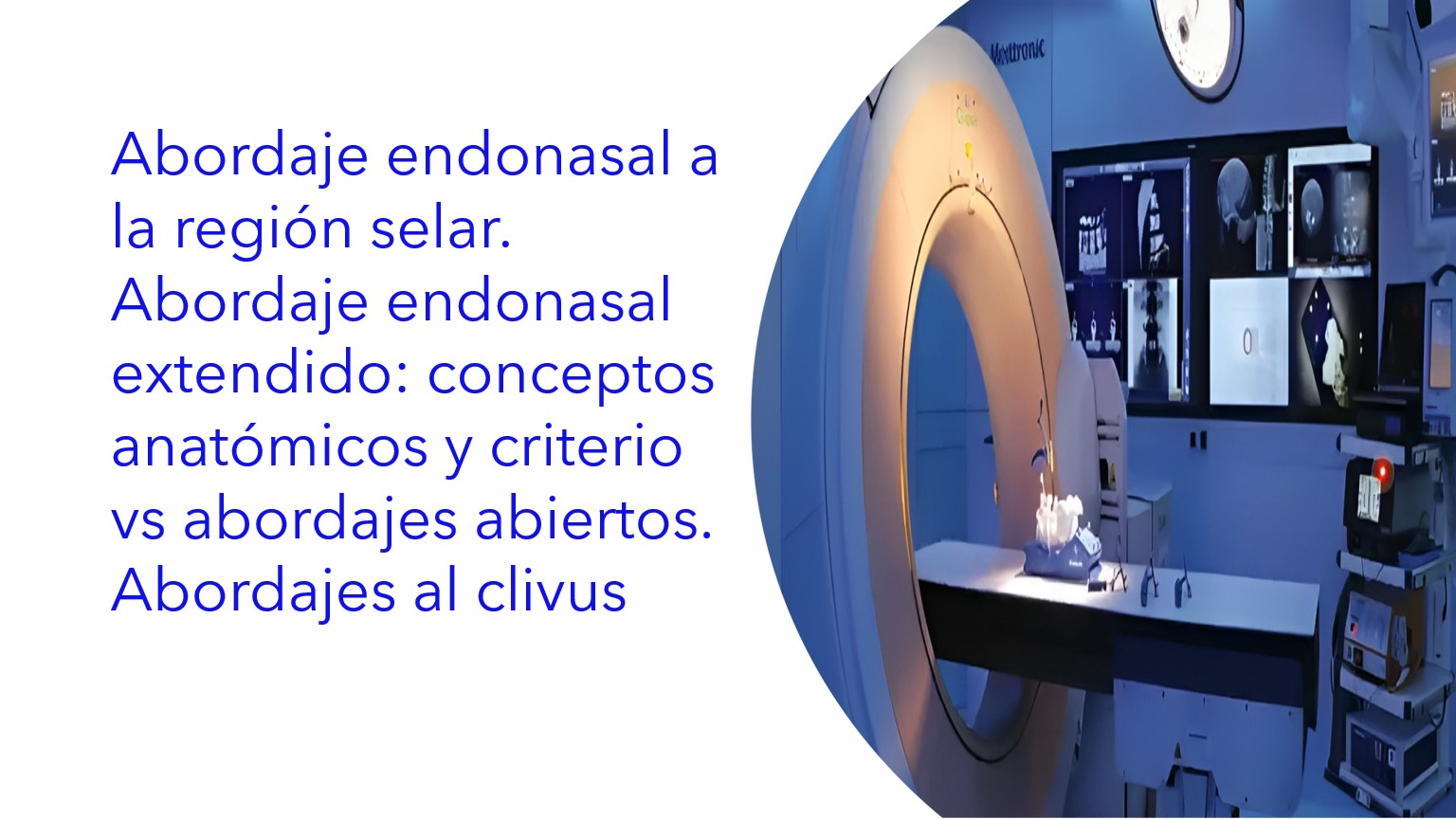 Abordaje Endonasal a la Región Selar. Abordaje Endonasal Extendido: conceptos anatómicos y criterio vs abordajes abiertos. Abordajes al Clivus