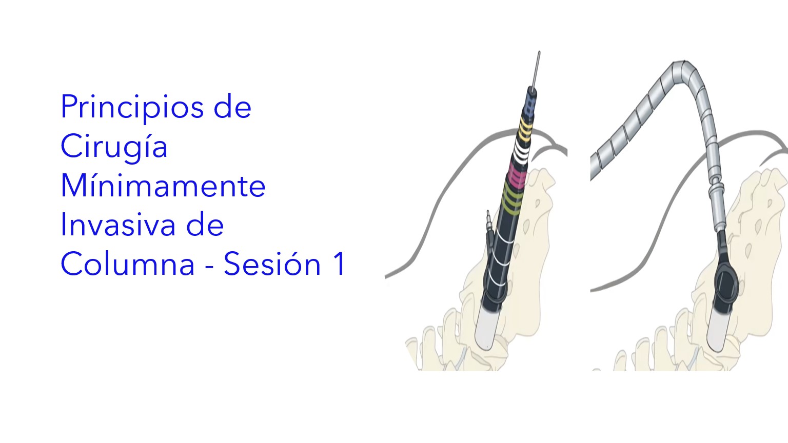 Principios de Cirugía Mínimamente Invasiva de Columna - Sesión 1