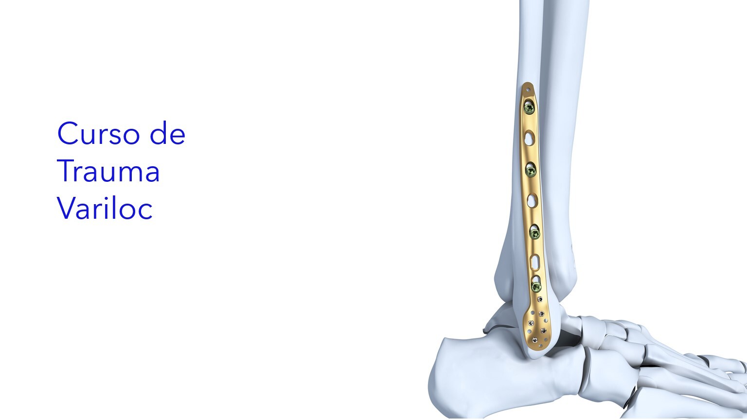 Curso de Trauma - Variloc